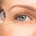 I vantaggi di un effetto lifting immediato per ridurre il rossore intorno agli occhi