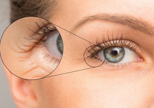 I vantaggi di un contorno occhi con effetto lifting istantaneo per combattere i segni dell'invecchiamento